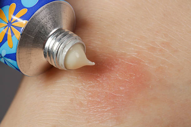 خرید و قیمت کرم پوست اسیب دیده و فروش صادراتی